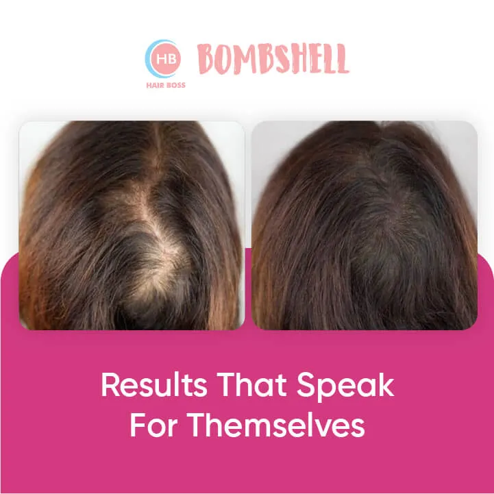 Bombshell Hair Growth Kit for Women: Treatment, Spray, 2-in-1 Shampoo/Conditioner